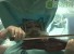 Пациентка играла на скрипке во время операции