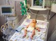 Первый в мире диализ почек у новорождённого Первый в мире диализ почек у новорождённого