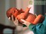 Медики впервые приняли роды у женщины с имплантированной маткой