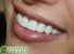 Состояние зубов может говорить об общем здоровье человека